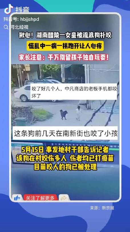 新澳2025资料最新大全和狗闯村民家咬伤女童与村里的狗咬人,应该找谁解决